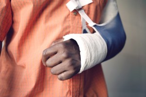 Closeup midsection of a man with broken arm in cast