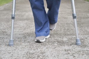 Picture of a person using crutches after fracture surgery.